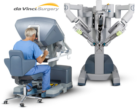 Robotic-Surgery-Beverly-Hills_06