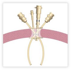 Robotic-Surgery-Beverly-Hills-6_06