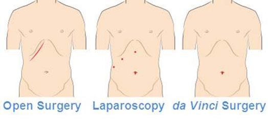 Robotic-Surgery-Beverly-Hills-6_14